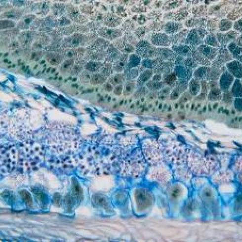 Cancer cells, working towards new therapeutic approaches