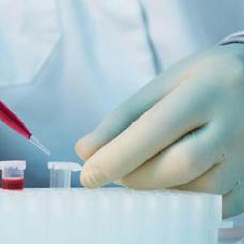 Two UniPD research projects selected in the fight against ALS