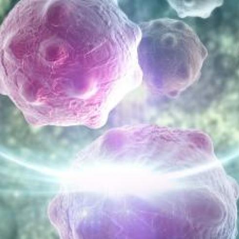 A new tract density index offers a reliable prognostic indicator for brain tumors