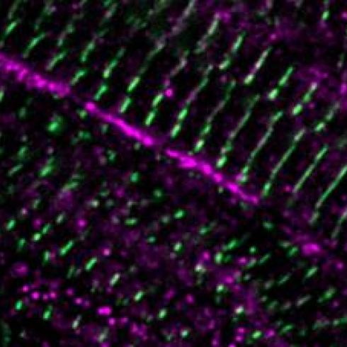 Research: heart and regeneration of damaged cells