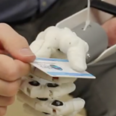 University of Padua Hospital unveils sophisticated bionic prostheses