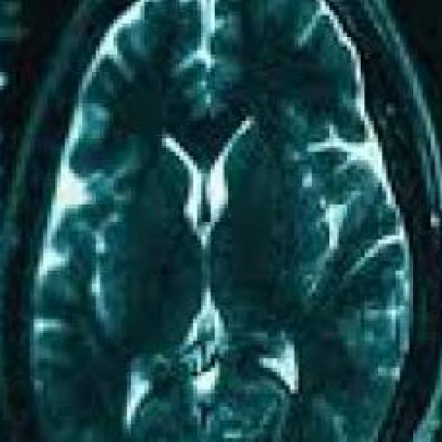 Gene therapy: promising discoveries against neurodegenerative diseases