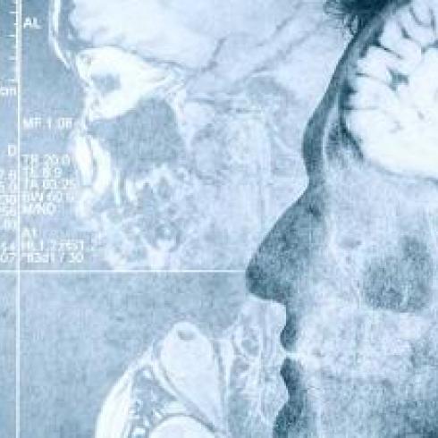 An Innovative Approach to Treat Brain Tumors