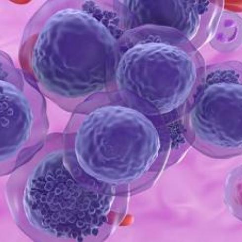 Chronic Lymphocytic Leukaemia: study demonstrates the effectiveness of biological therapies in elderly patients