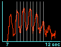 L_curve expanded