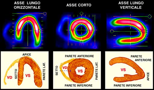 Sezioni_Miocardiche