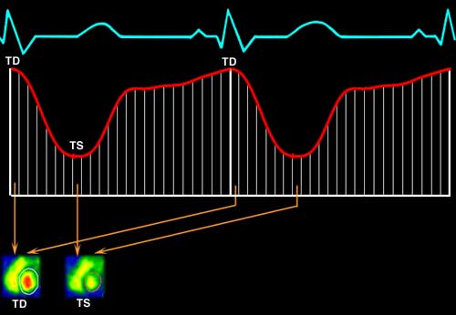 SymaCurva+ECG