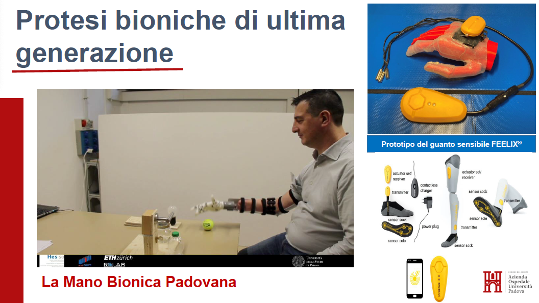 protesi bioniche di ultima generazione