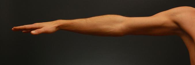arm