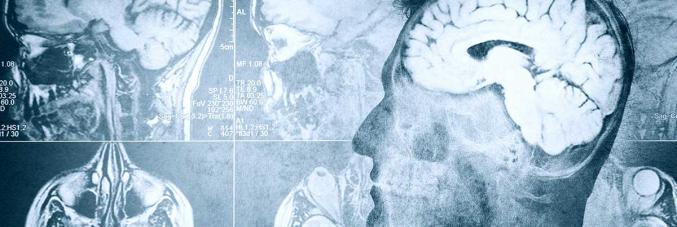 brains