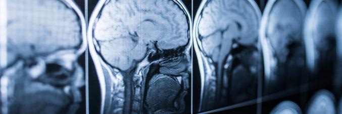 brain