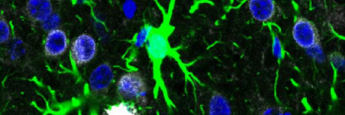 Immagine della corteccia somatosensoriale del modello murino, ottenuta al microscopio. Sono visibili gli astrociti (in verde), gli accumuli di beta-amiloide (in bianco) e i nuclei cellulari (in blu)