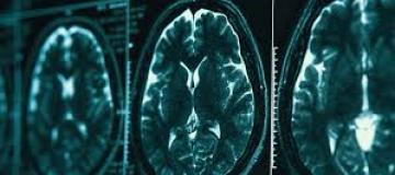 radiografie craniche