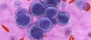 leukemia